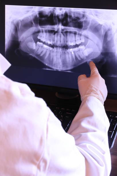 Best Urgent Care for Lost Fillings or Crowns in Litchfield, MI