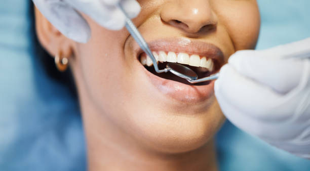 Best Emergency Tooth Extraction in Litchfield, MI