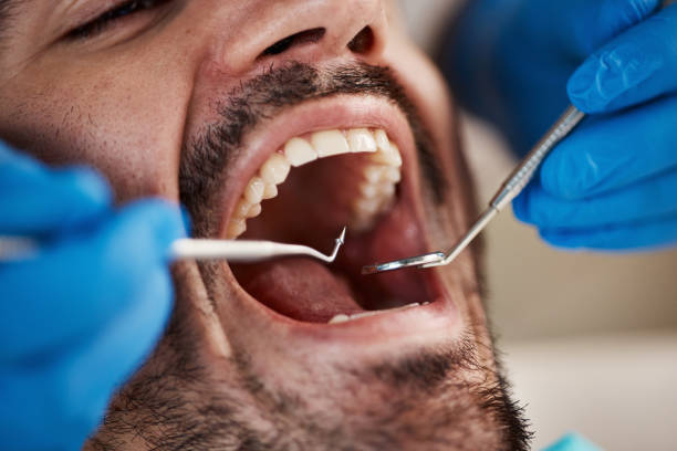 Best Cosmetic Emergency Dentistry in Litchfield, MI