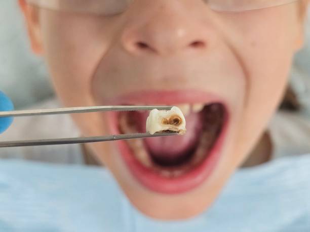 Best Emergency TMJ Treatment in Litchfield, MI
